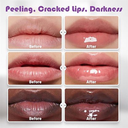 Seurico Lip Care Set - Exfoliate, Reduce Lip Lines, Hydrate