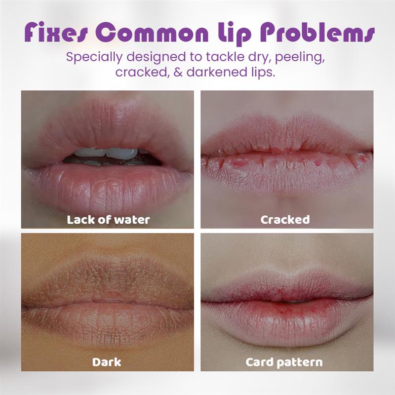 Seurico Lip Care Set - Exfoliate, Reduce Lip Lines, Hydrate