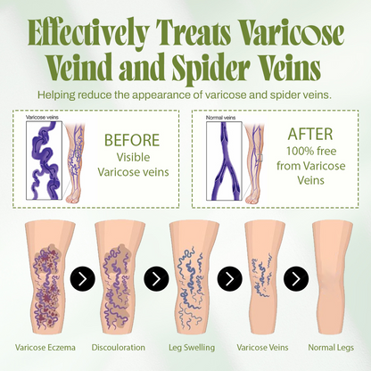 🍃Seurico™ Vein Relief Cream