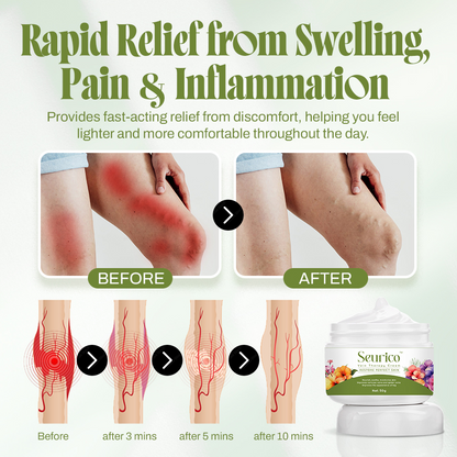 🍃Seurico™ Vein Relief Cream