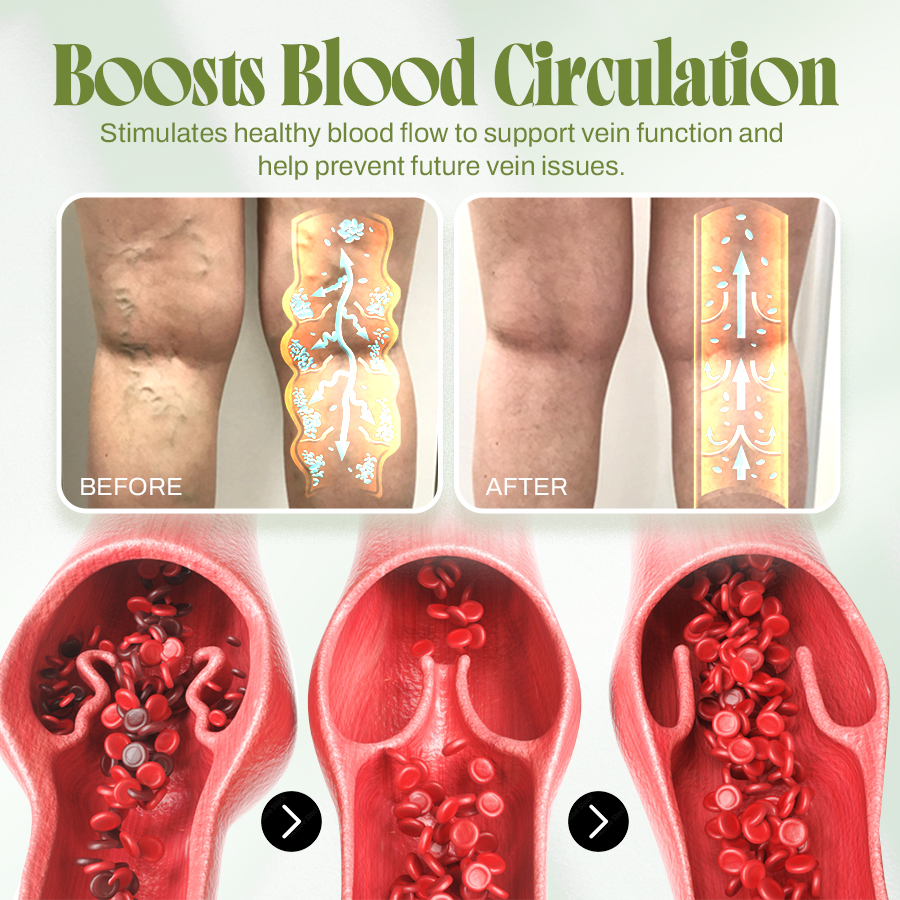 🍃Seurico™ Vein Relief Cream