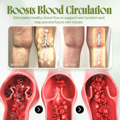 🍃Seurico™ Vein Relief Cream