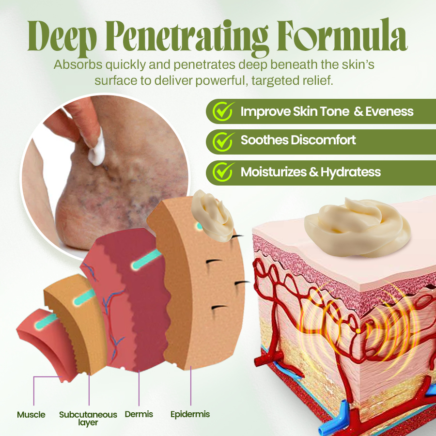 🍃Seurico™ Vein Relief Cream