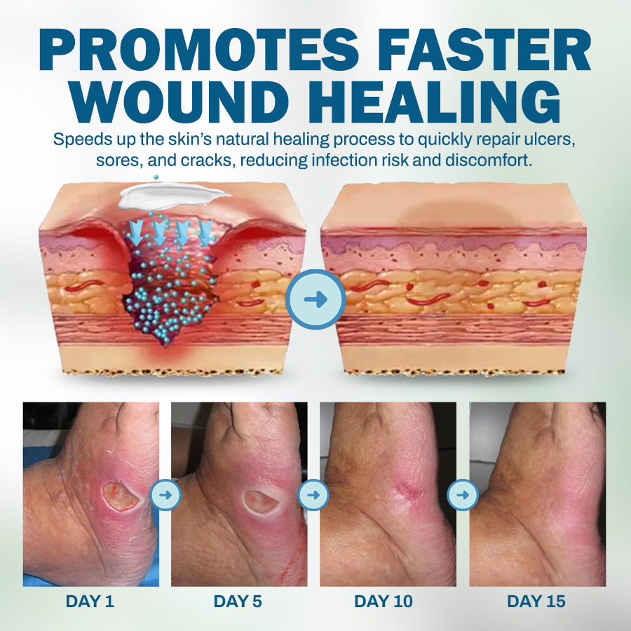NEGUSY™ Wound & Ulcer Healing Solution