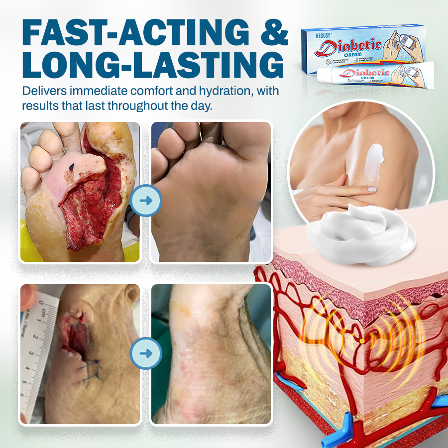 NEGUSY™ Wound & Ulcer Healing Solution