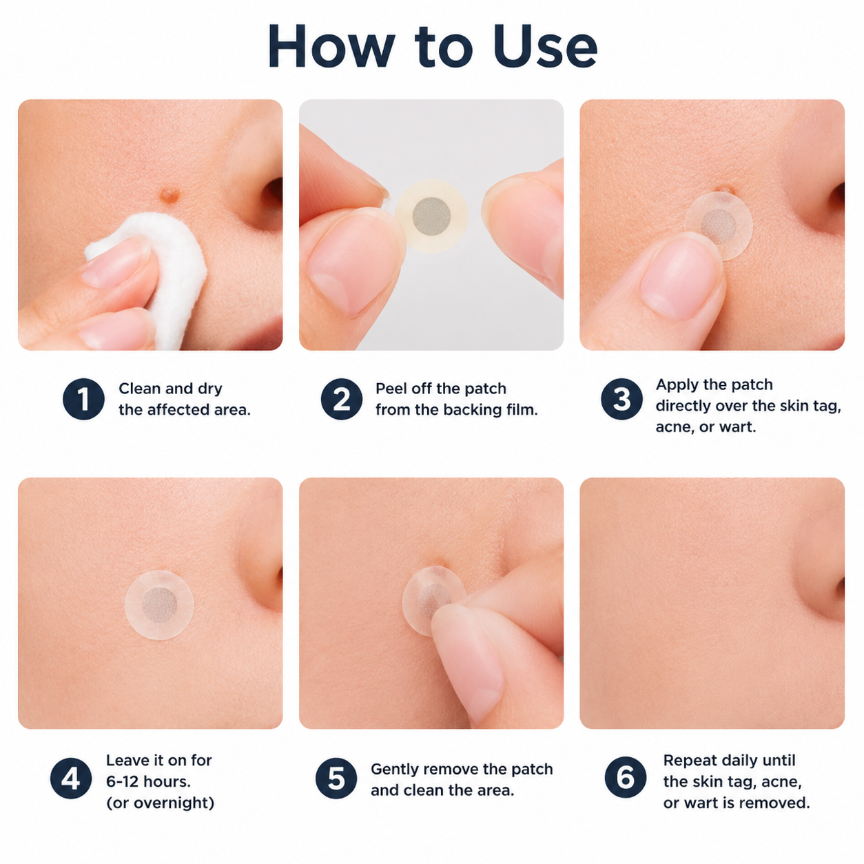 ✅🇺🇸𝐇𝐞𝒂𝒍𝗿𝗶𝙯𝙚®2-in-1 Microneedle & Hydrocolloid Patch🎀| Removes Raised Moles, Acne, Flat Warts & Skin Tags | Helps Improve Wrinkles, Scars & Blemishes | Invisible Patches for Face & Body