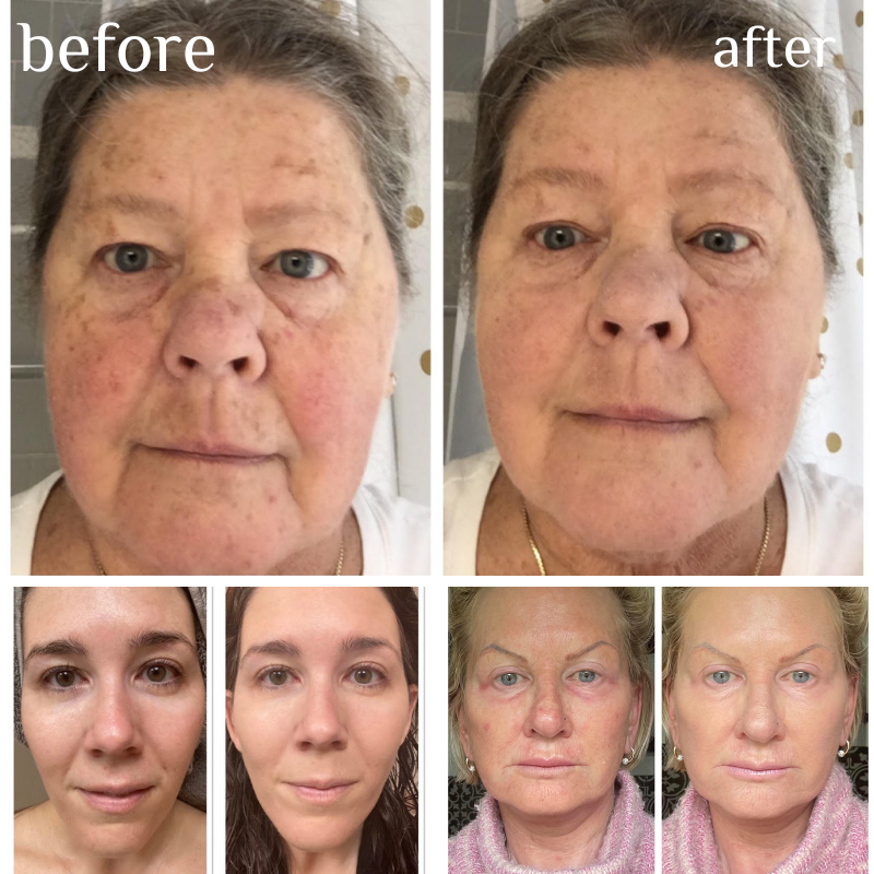 NEGUSY™ Skin Tone Adjusting CC Cream SPF 43