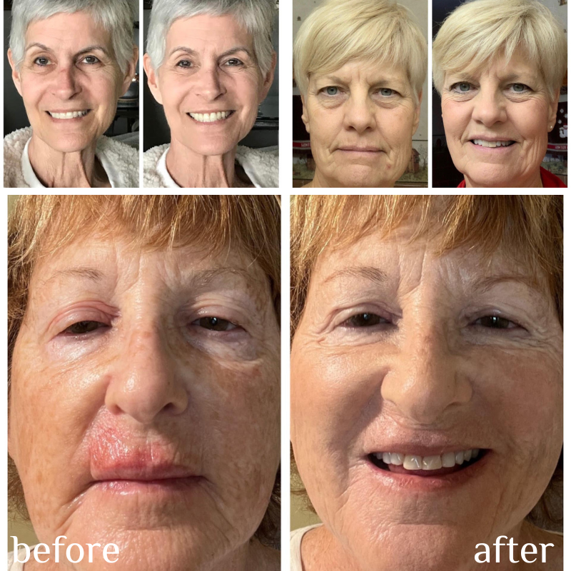 NEGUSY™ Skin Tone Adjusting CC Cream SPF 43