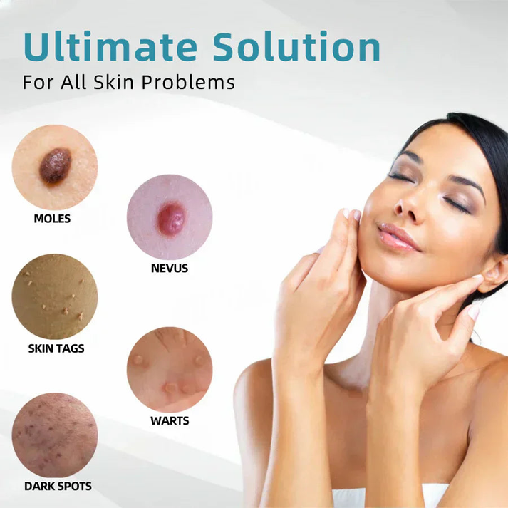 ✨NEGUSY™ All-in-One CO₂ Laser Eraser Pen | Removes Moles, Warts, Skin Flaws & Pigmentation
