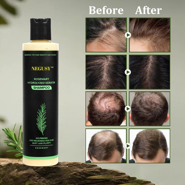 🔥LAST DAY 50% OFF - 🎅NEGUSY™ Organic Rosemary Hair Growth Shampoo