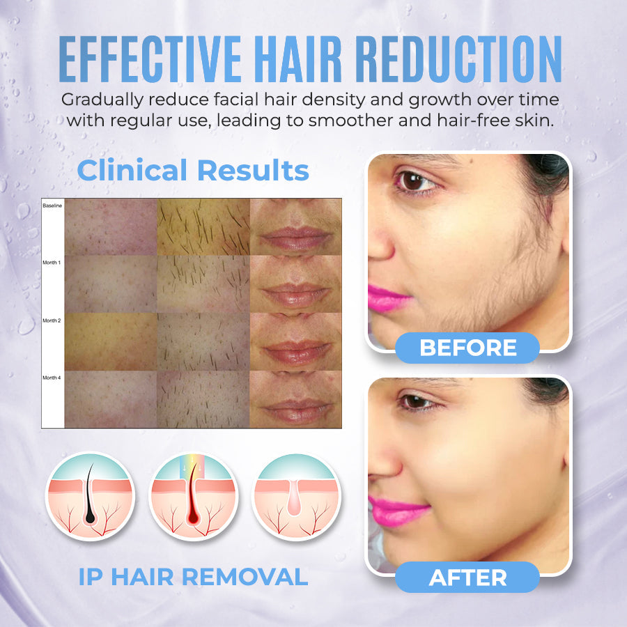 PCOS Facial Hair Natural Treatment At Home