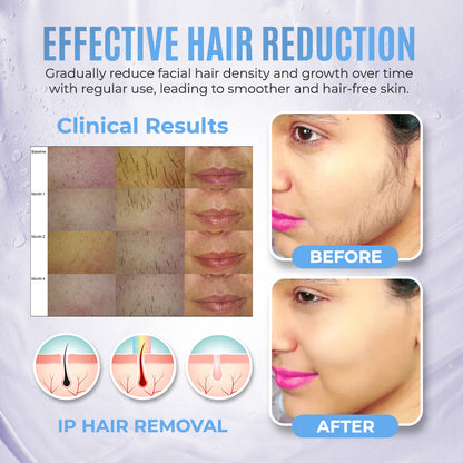 PCOS Facial Hair Natural Treatment At Home