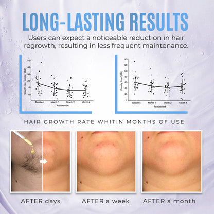 PCOS Facial Hair Natural Treatment At Home