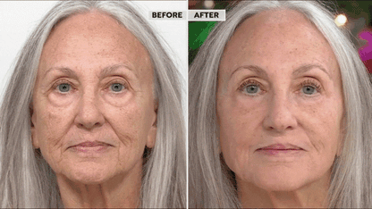 Zakdavi™ Fast Elevate Multi-Peptide Serum