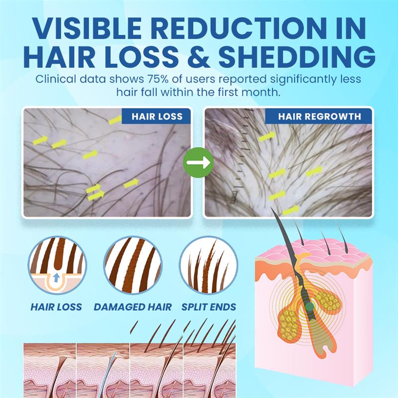 NEGUSY™ Hair Regrowth Stick