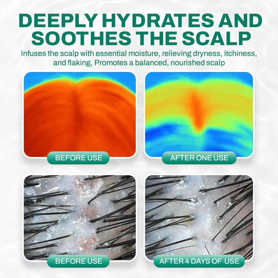 NEGUSY™ PDRN Follicle Repair Essence