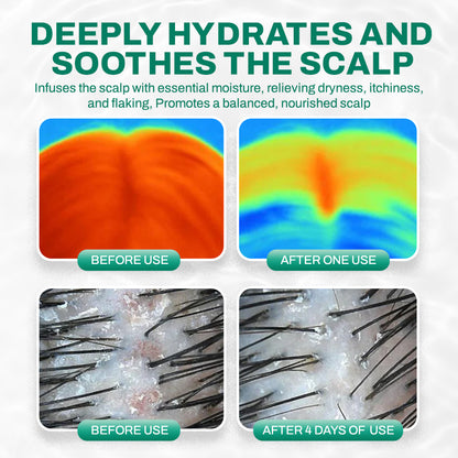 NEGUSY™ PDRN Follicle Repair Essence