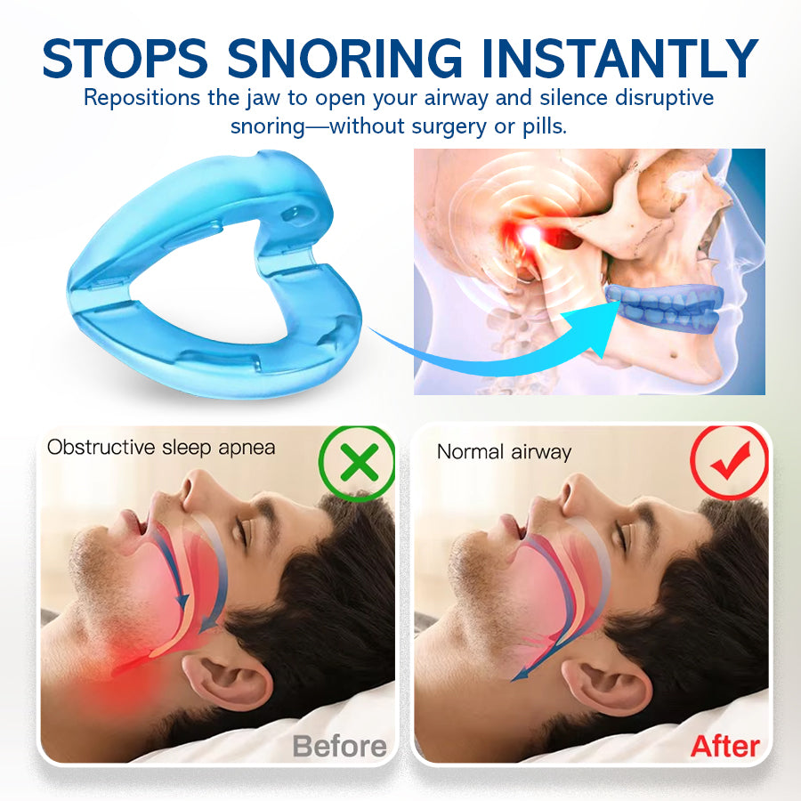 🔹NEGUSY™ Silent Sleep Mouthpiece