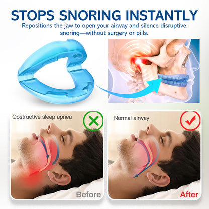 🔹NEGUSY™ Silent Sleep Mouthpiece