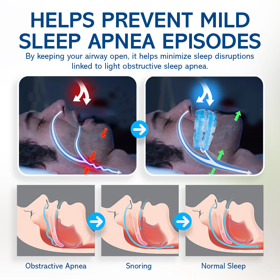 🔹NEGUSY™ Silent Sleep Mouthpiece