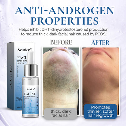 PCOS Facial Hair Natural Treatment At Home