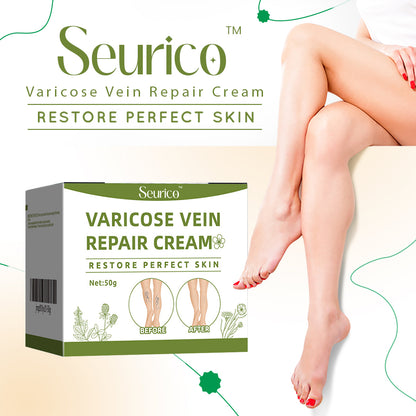 Seurico™ Varicose Vein Relief Cream🌿