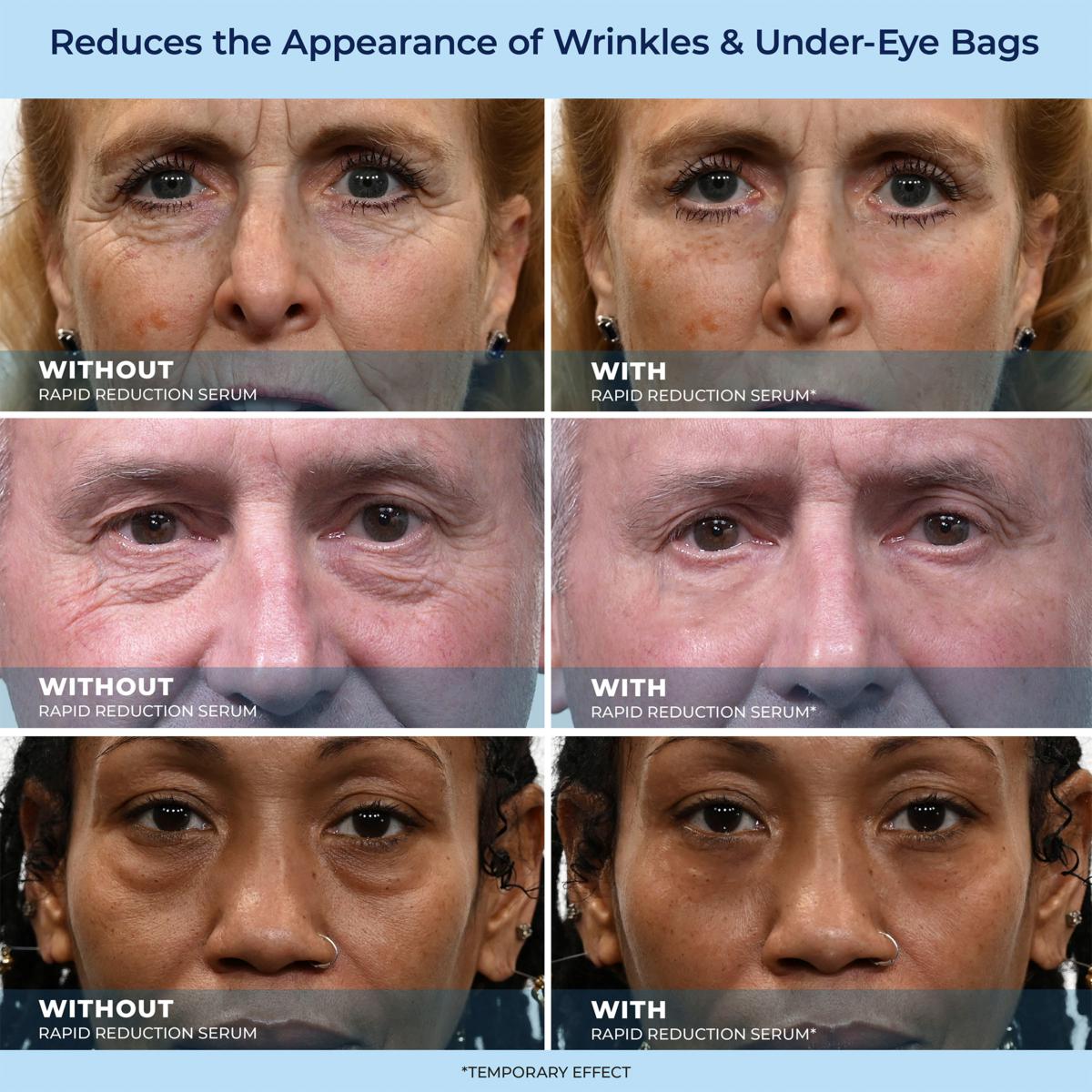 LBMLBM™ Rapid Reduction Wrinkle Serum