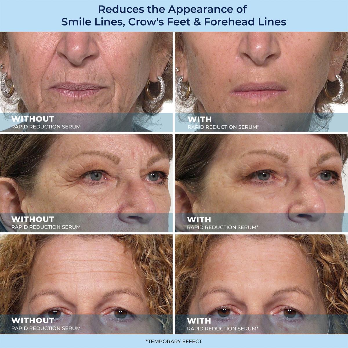 LBMLBM™ Rapid Reduction Wrinkle Serum